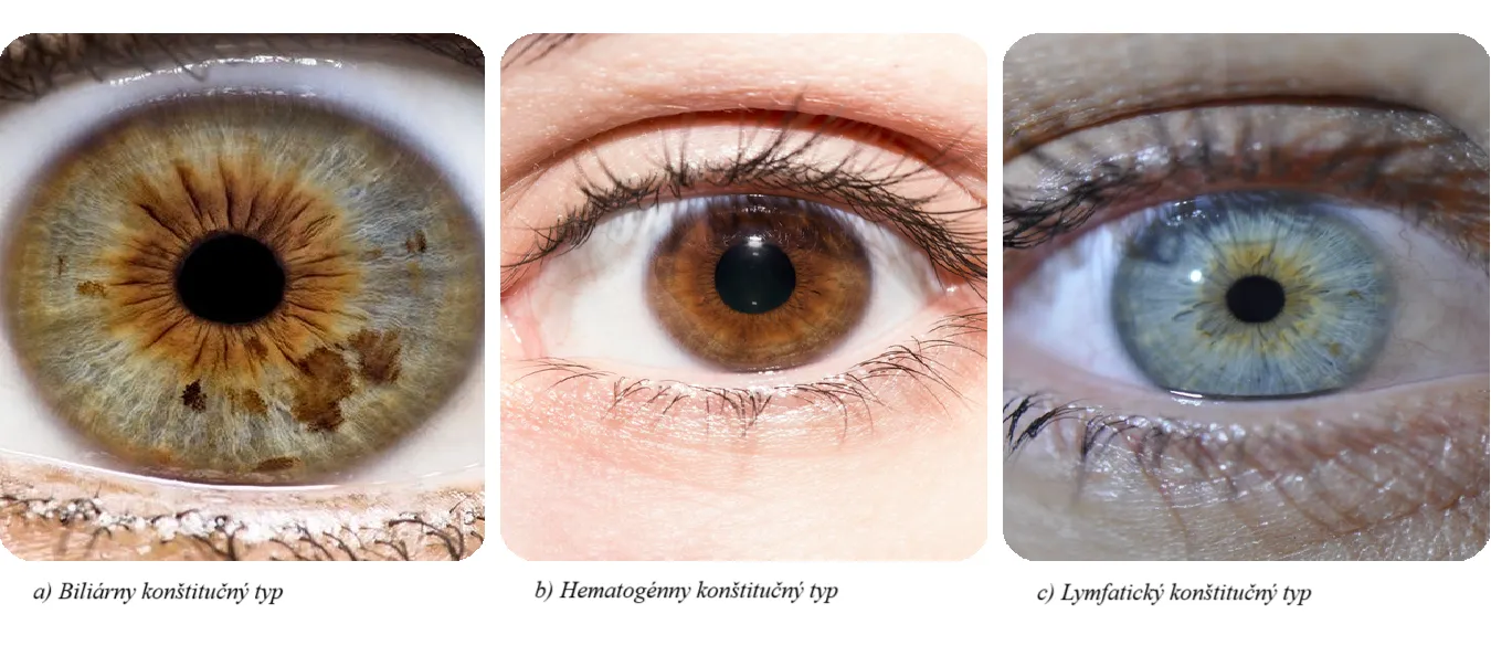 Fyzická odolnosť / Genetické typy